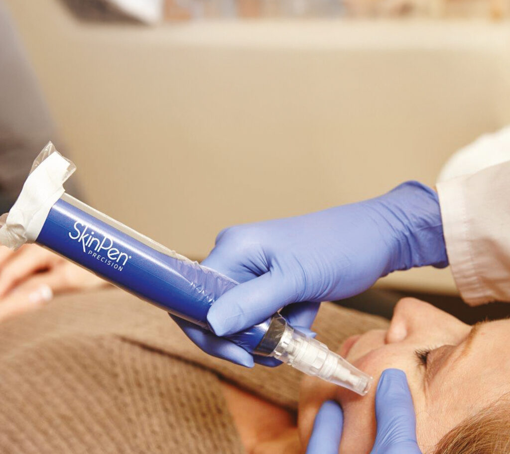 SkinPen Microneedling Tone Cosmetics in Zofingen